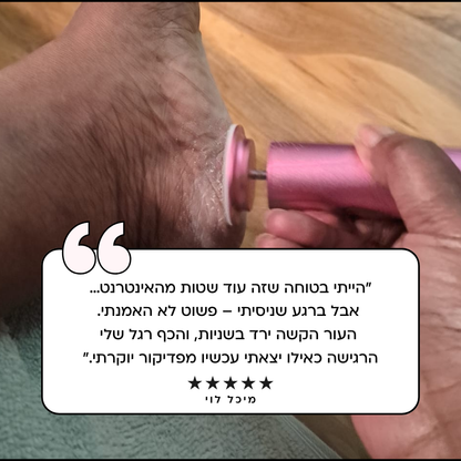 Alonty ערכת פדיקור חשמלית אלחוטית: רגליים חלקות, טיפוח מושלם בבית