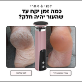 Alonty ערכת פדיקור חשמלית אלחוטית: רגליים חלקות, טיפוח מושלם בבית