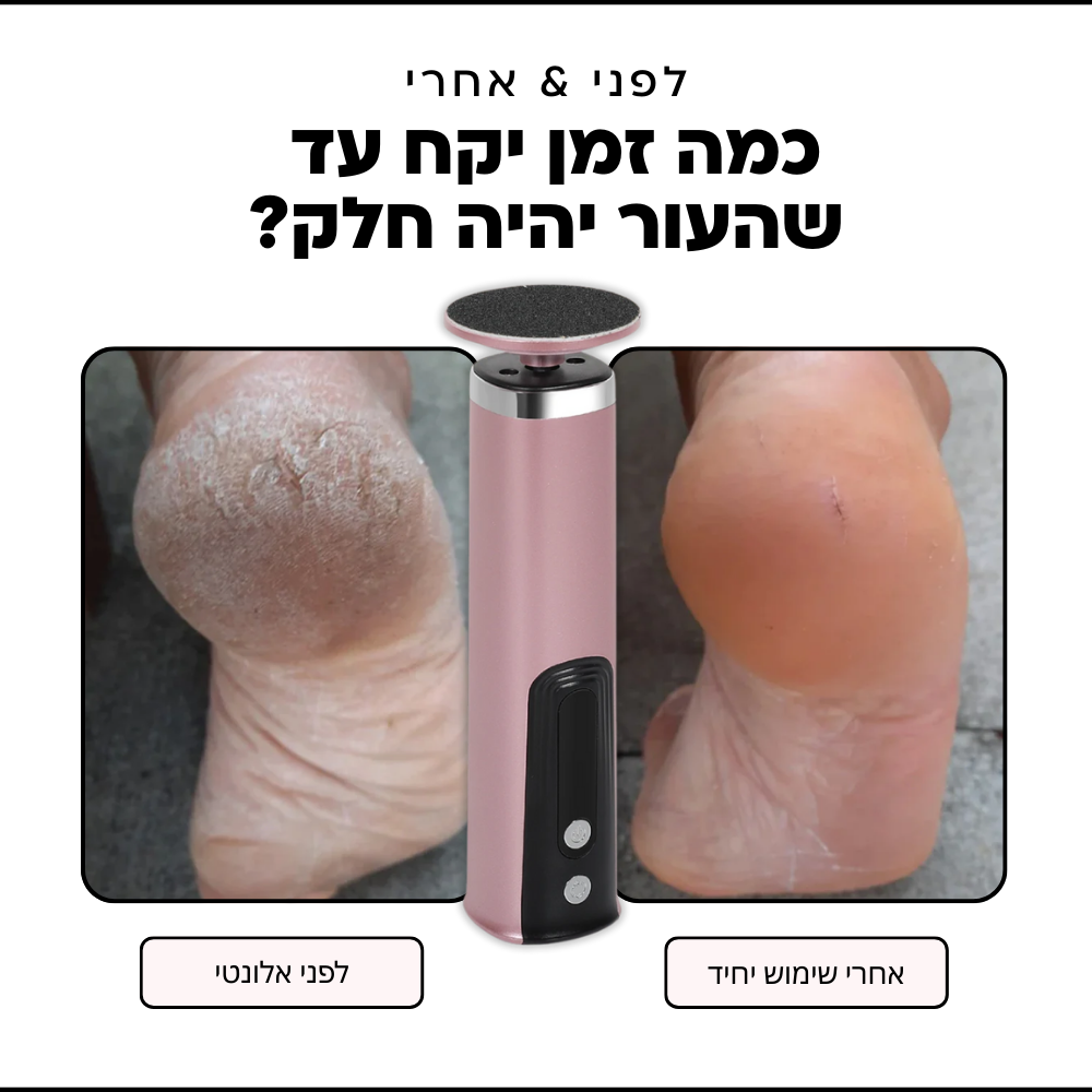 Alonty ערכת פדיקור חשמלית אלחוטית: רגליים חלקות, טיפוח מושלם בבית