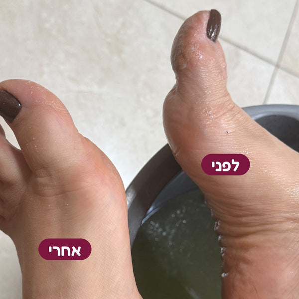 תוצאת לפני ואחרי — מכשיר הפדיקור Blendy